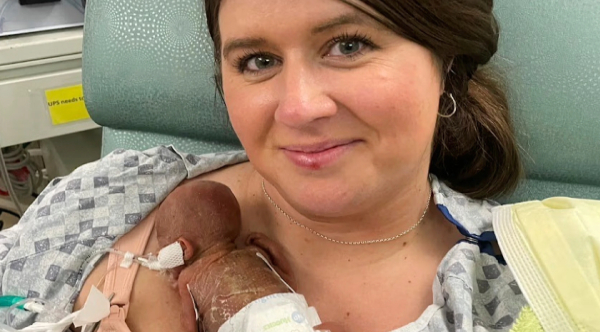 World’s Most Premature Surviving Baby Turns One, Sets New Guinness Record