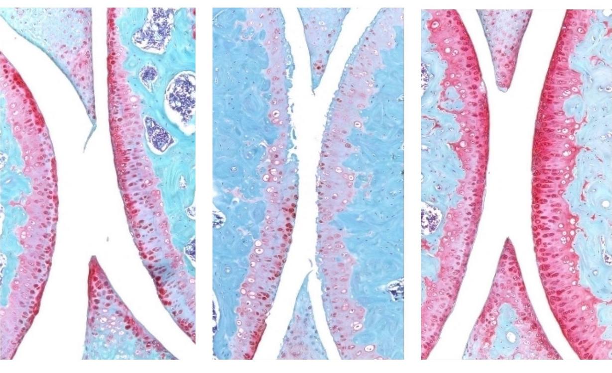 Anti-Aging Drug Regrows Knee Cartilage in Major Breakthrough That Could End Knee Replacements